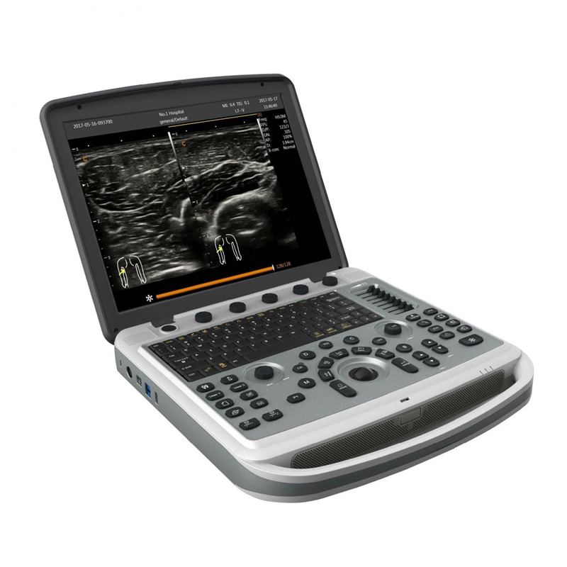 Chison SonoTouch 80 Pro