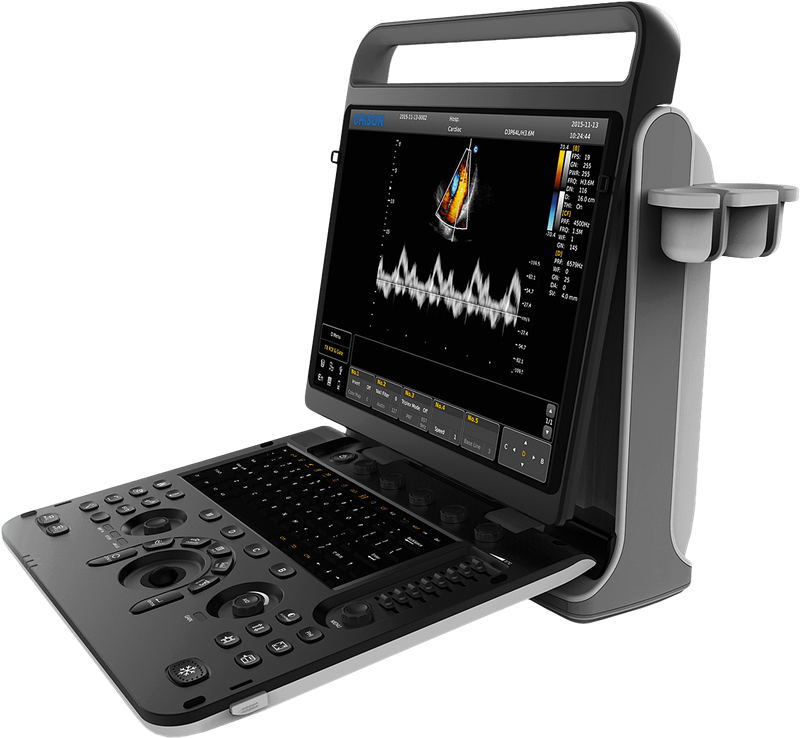 Chison SonoTouch 60