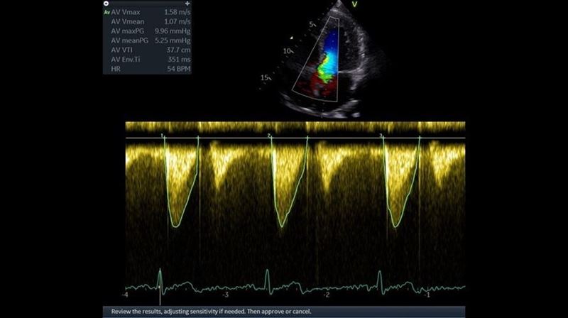 GE Healthcare Vivid T9
