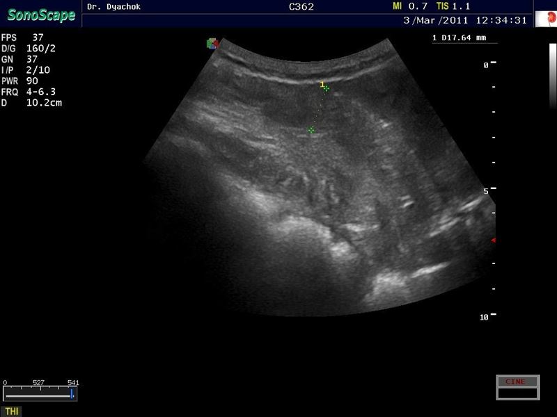 Sonoscape S8 exp Vet
