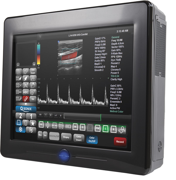 UltraSonix SonixTablet