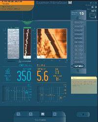 Echosens FibroScan 502 Touch