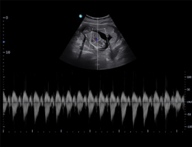 Chison Sonoair
