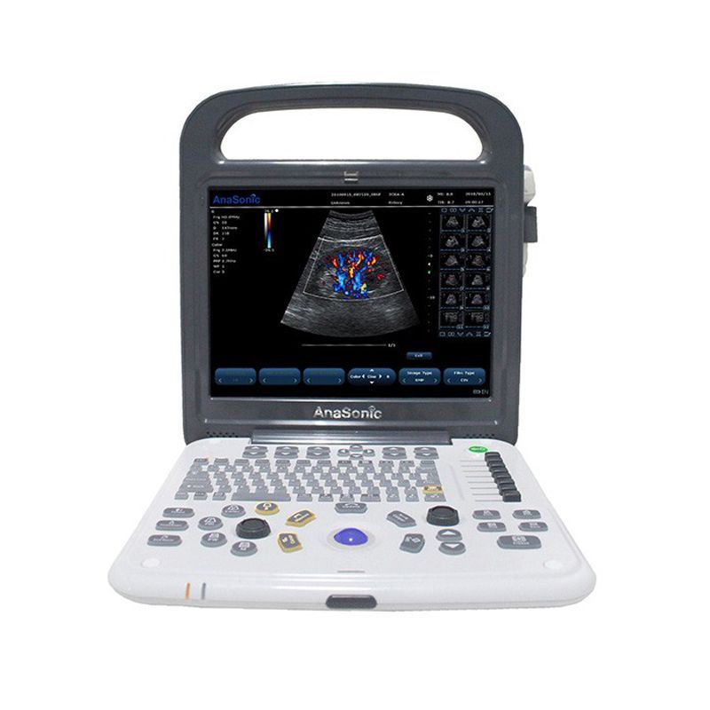 AnaSonic C3