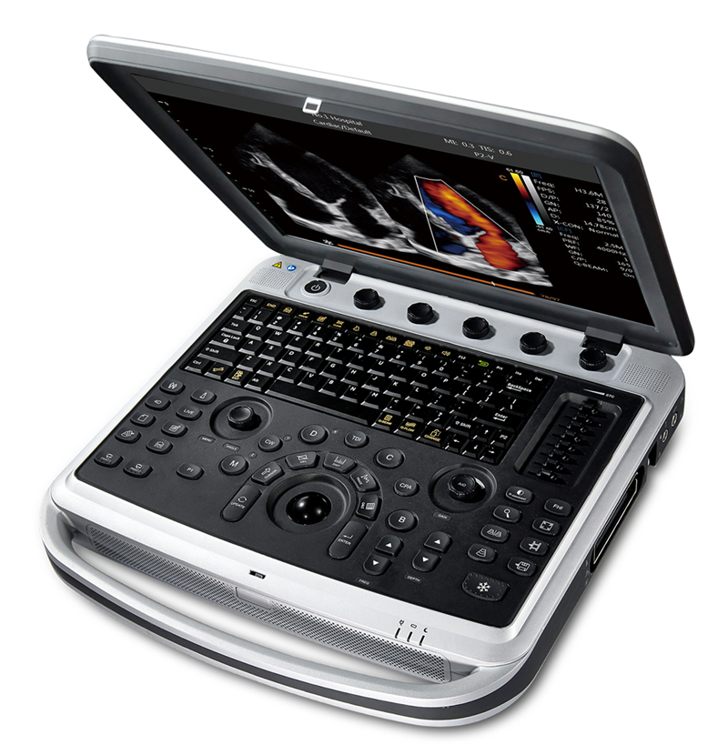Chison SonoTouch 80
