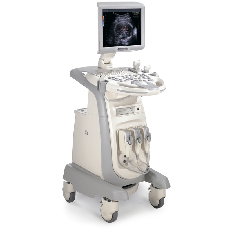 Samsung SonoAce-X6