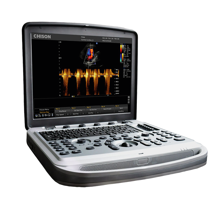 Chison SonoTouch 80 Pro