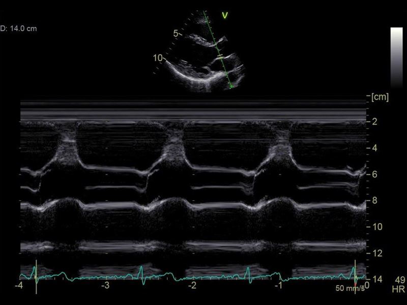 GE Healthcare Vivid S70