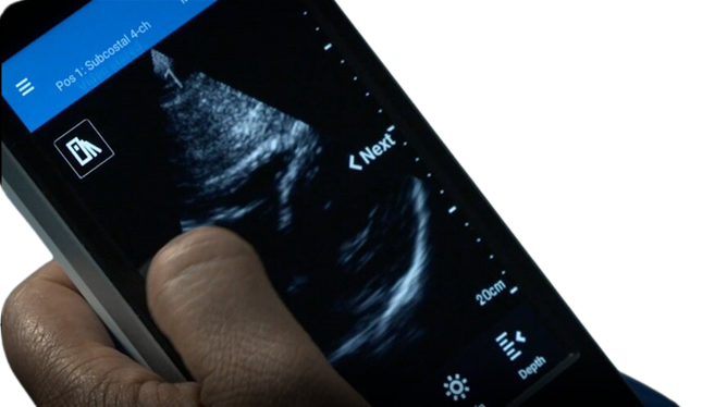 GE Healthcare Vscan