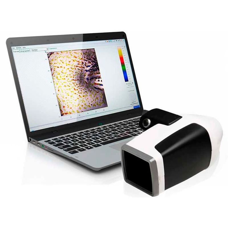 Miravex Antera 3D