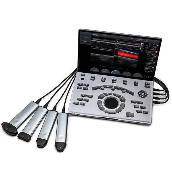 Chison Sonoair