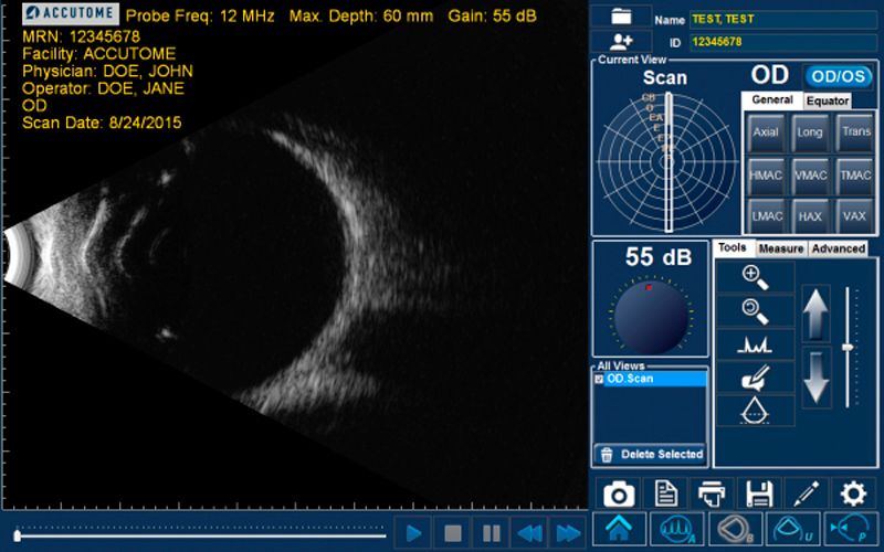 Accutome by Keeler B-scan Plus