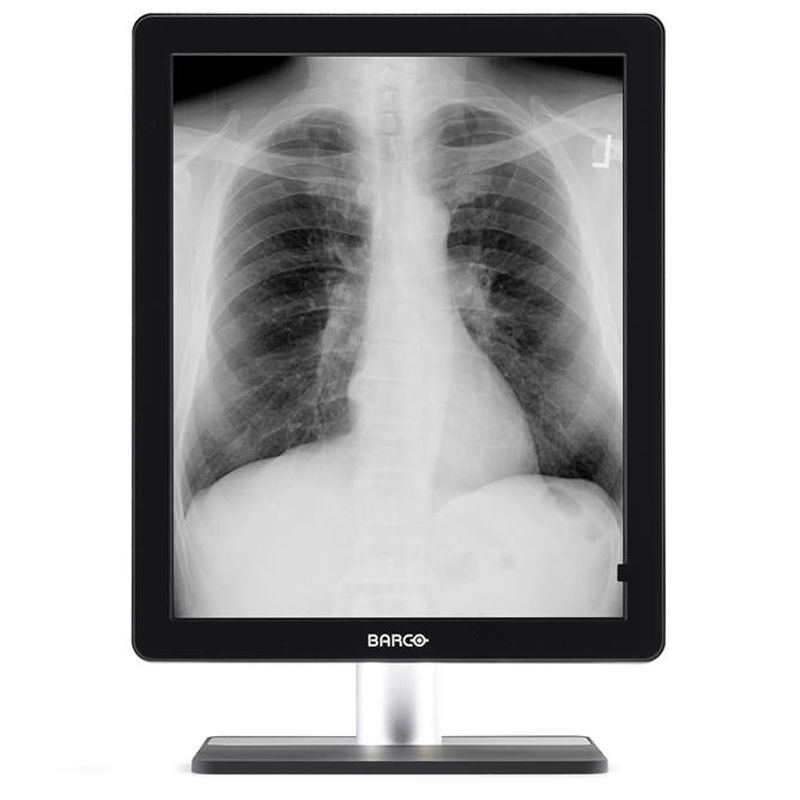 Barco Coronis 5MP LED MDCG-5221