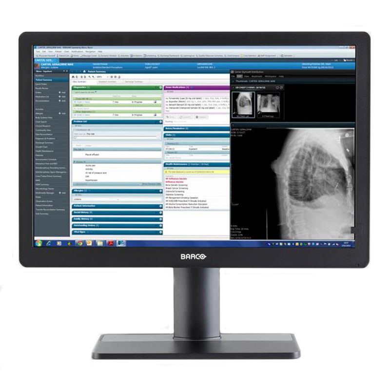 Barco Eonis 24" (MDRC-2324)