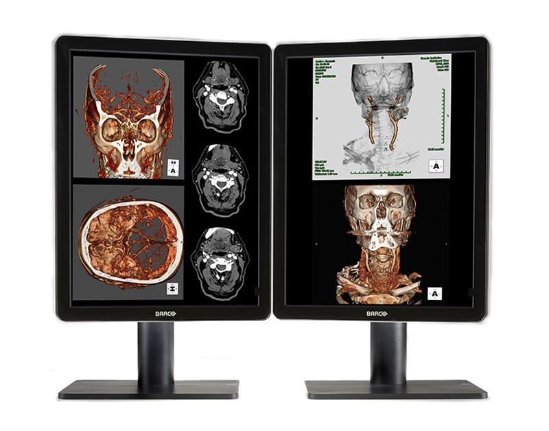 Barco Nio Color 2MP LED MDNC-2221