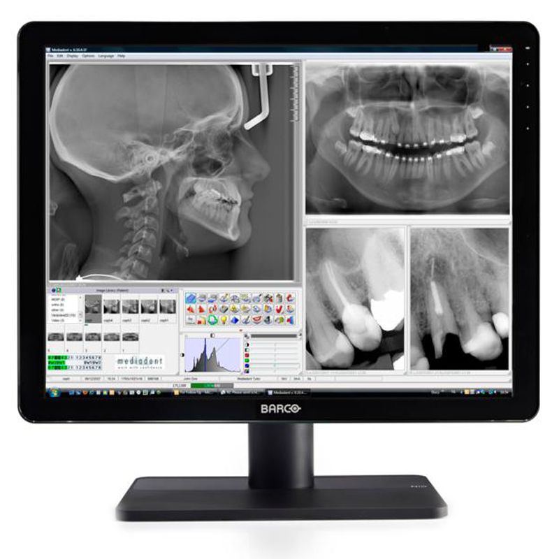 Barco Nio Color 3MP Dental