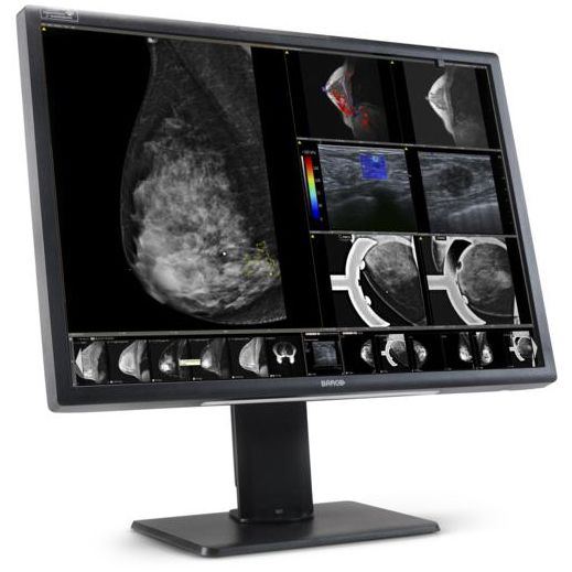 Barco Nio Fusion 12MP MDNC-12130