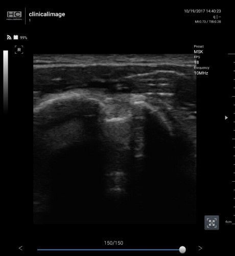 Healcerion Sonon 300C