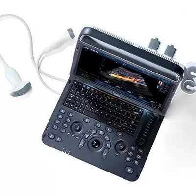 Chison SonoTouch 60 OB