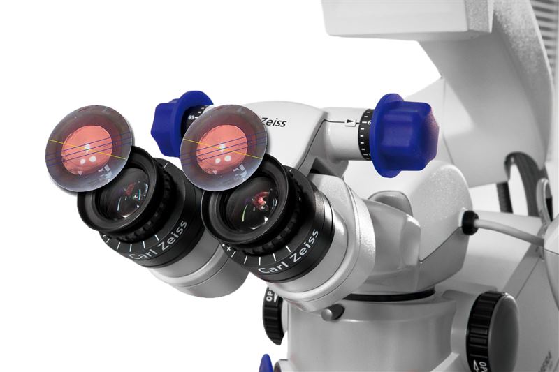 Carl Zeiss Callisto Eye
