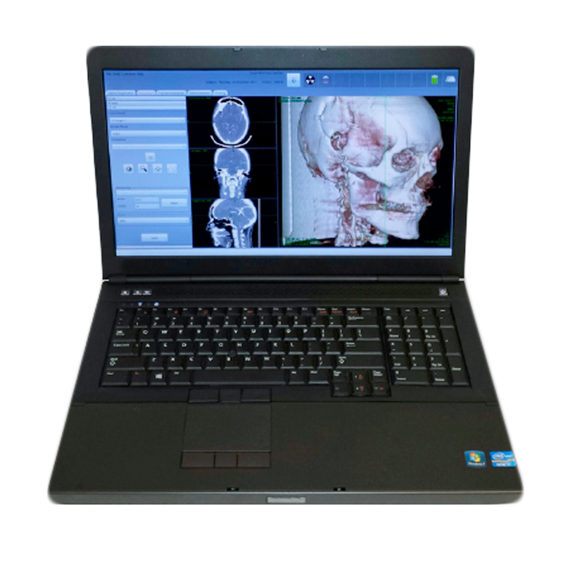 NeuroLogica CereTom