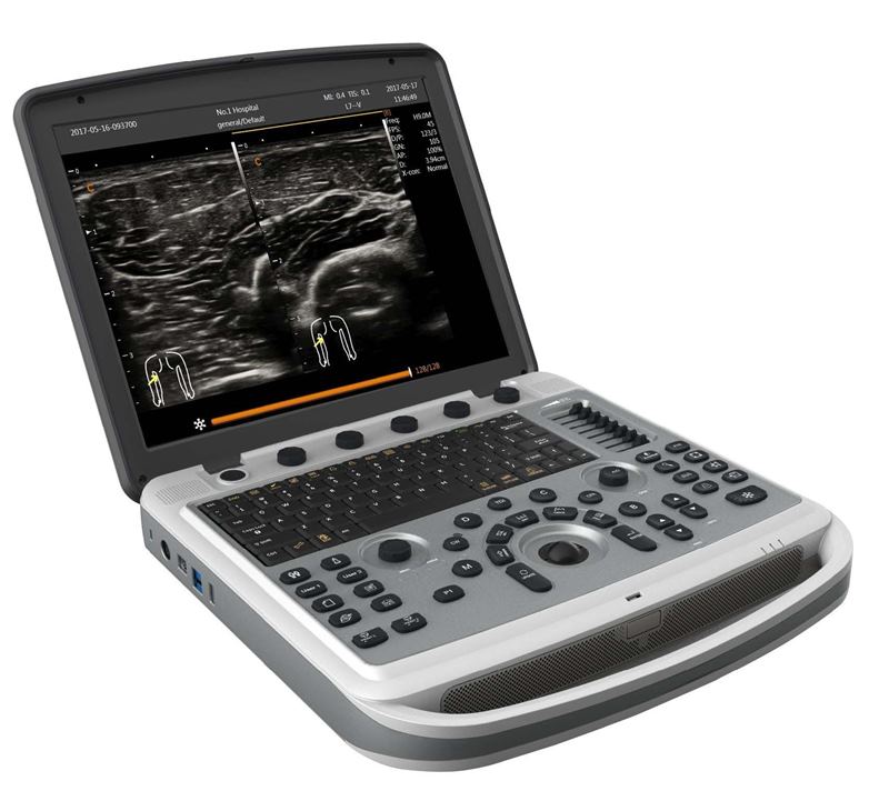 Chison SonoTouch 80