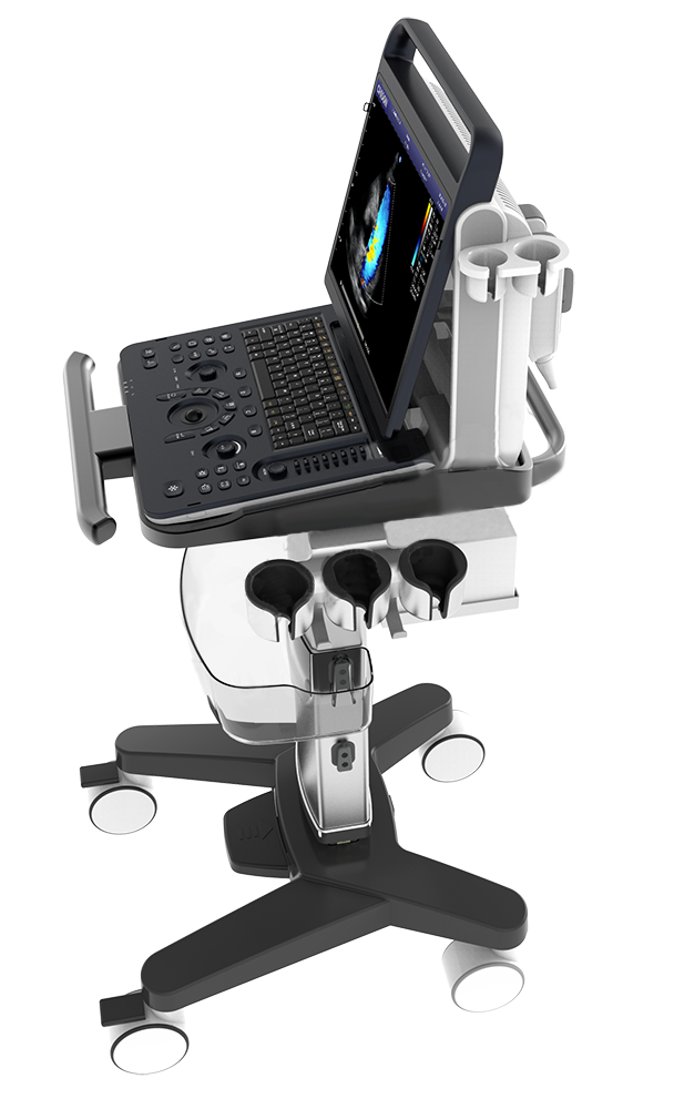 Chison SonoTouch 60