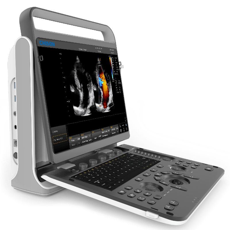 Chison SonoTouch 60