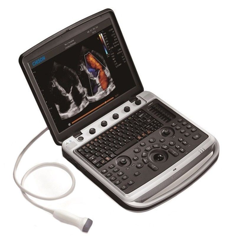 Chison SonoTouch 80 Exp