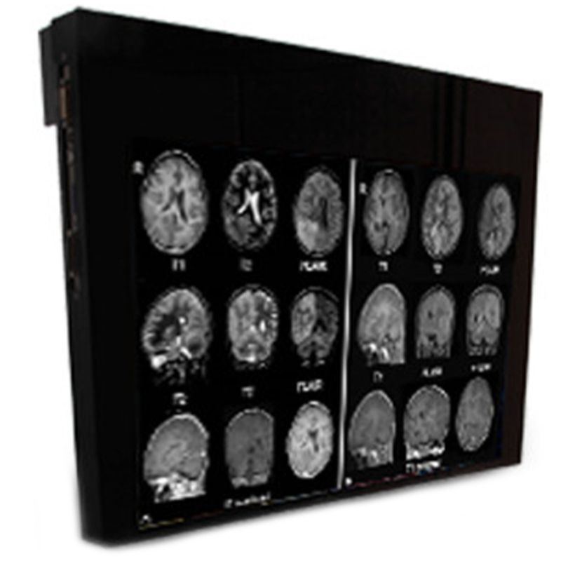 Double Black Imaging 24″ MRSafe Display