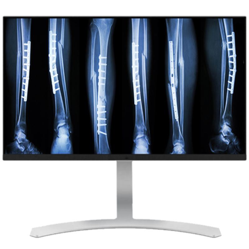 Double Black Imaging 27″ 8MP Color Clinical LED