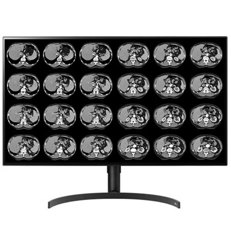 Double Black Imaging 32″ Color 8MP Large Format Display