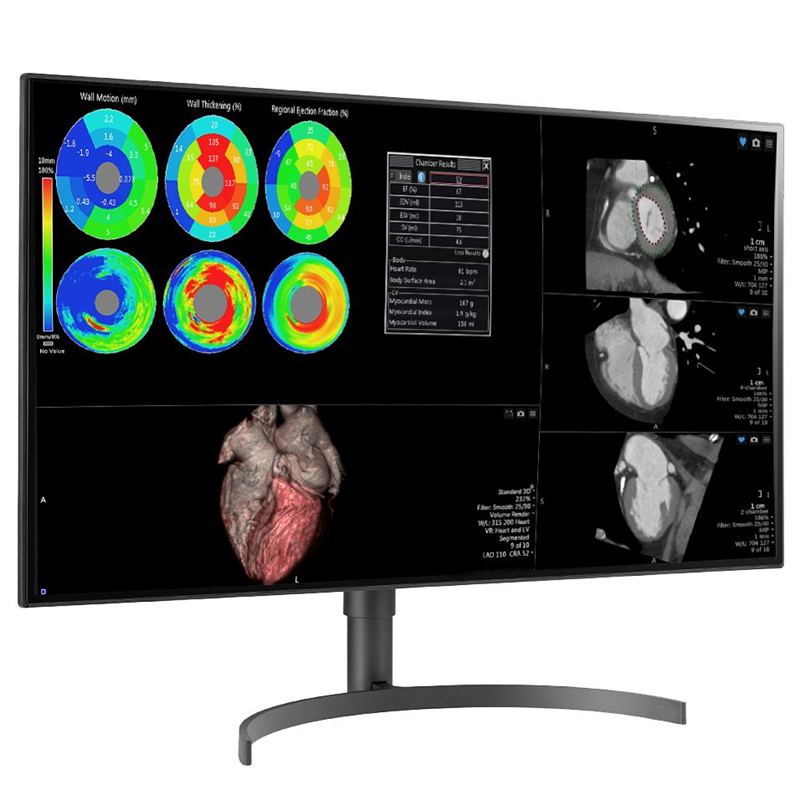 Double Black Imaging 32″ Color 8MP Large Format Display