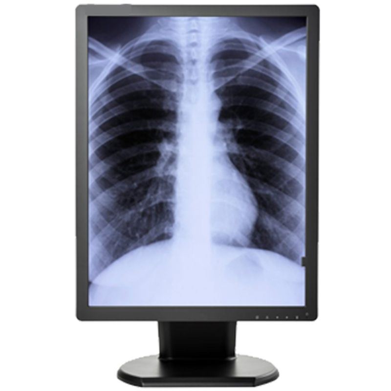 Double Black Imaging 3MP Monochrome Diagnostic Display