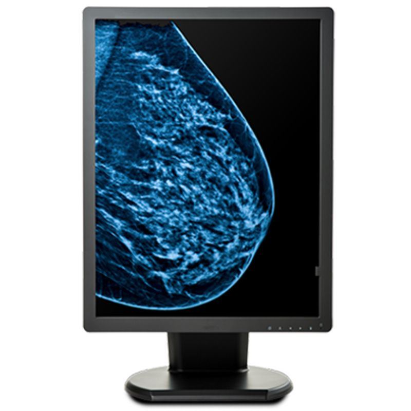 Double Black Imaging 5MP Color Display For Mammo And Tomo