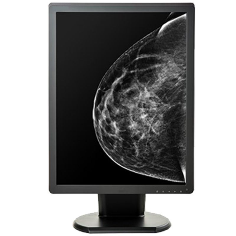Double Black Imaging 5MP Monochrome Display For Mammography And Tomo