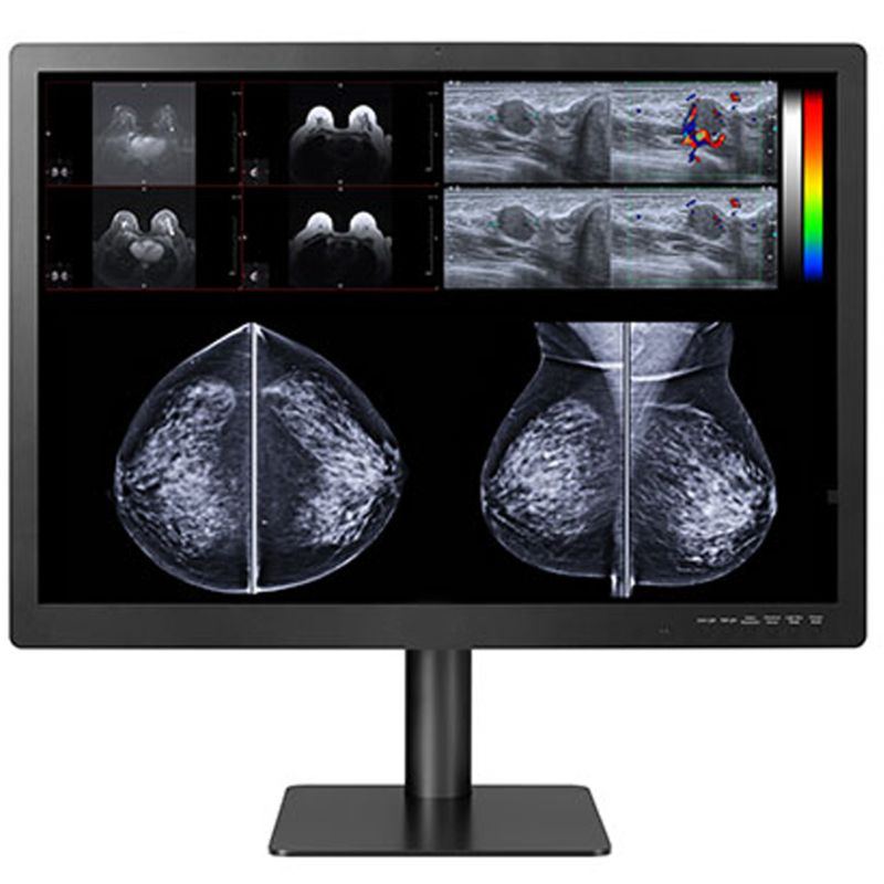 Double Black Imaging Gemini Series 12 MP Large Format Display