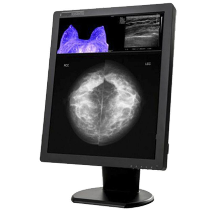 Double Black Imaging Image Systems 5MP Color Diagnostic Display (C5MPN)