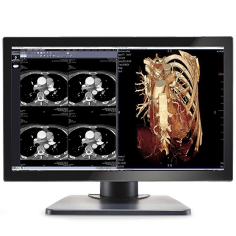 Double Black Imaging Image Systems Gemini 4MP Large Format Display