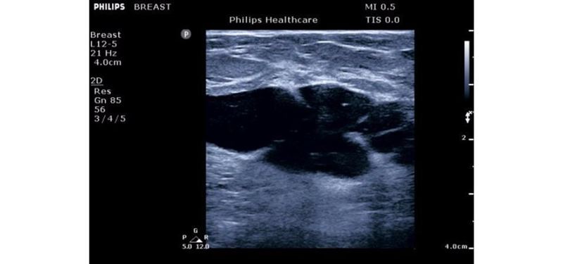Philips ClearVue 650