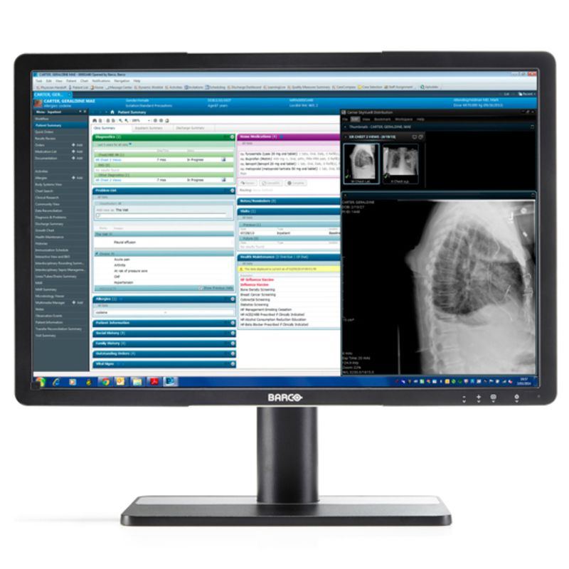Barco Eonis 22" (MDRC-2222 Option BL)
