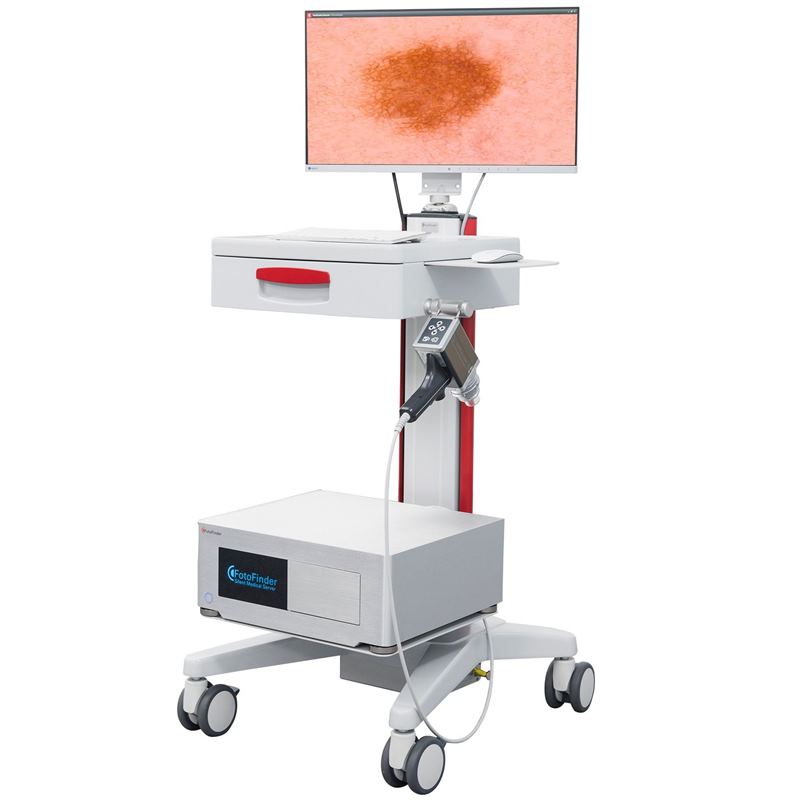 FotoFinder Dermoscope Vexia