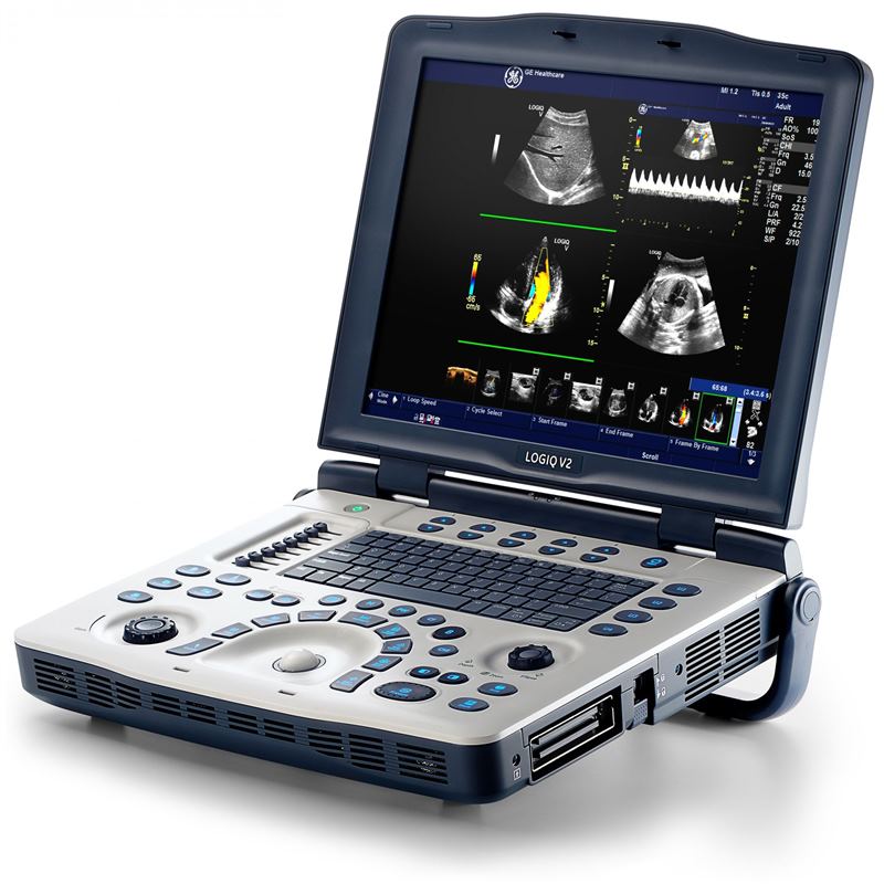 GE Healthcare Logiq V2