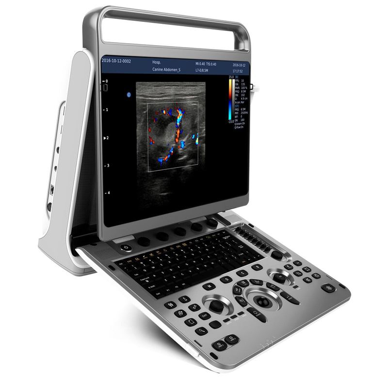 Chison SonoTouch 60 OB