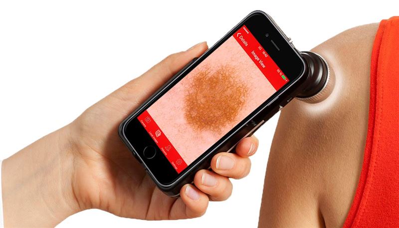 FotoFinder Handyscope NEW