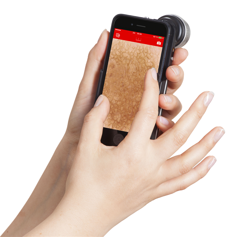 FotoFinder Handyscope NEW