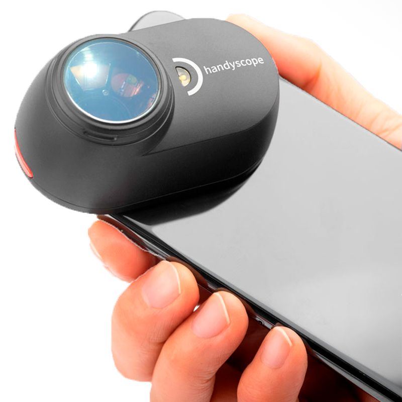 FotoFinder Handyscope NEW