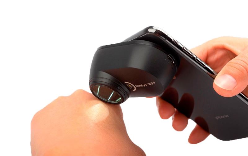 FotoFinder Handyscope NEW