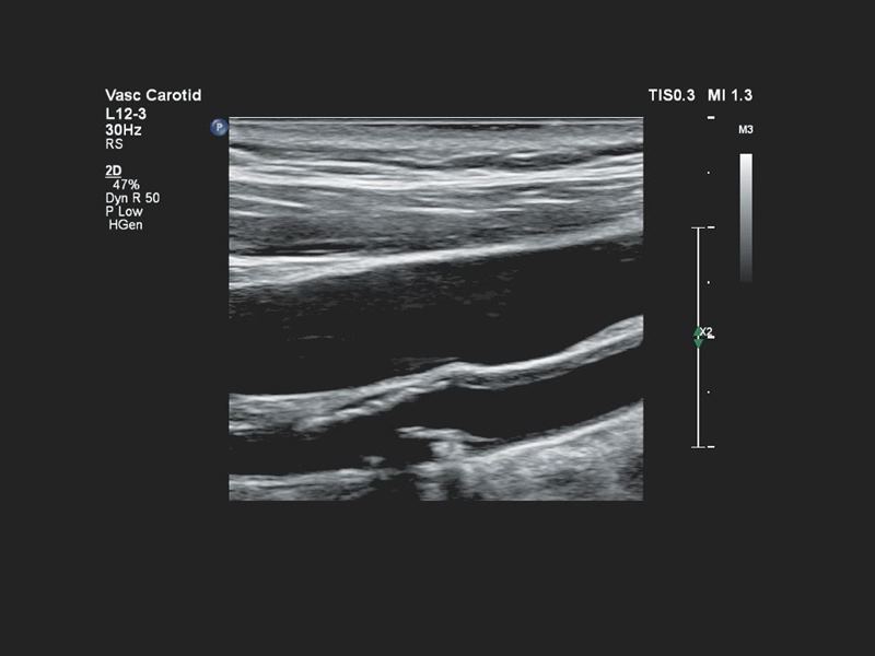 Philips Affiniti 70