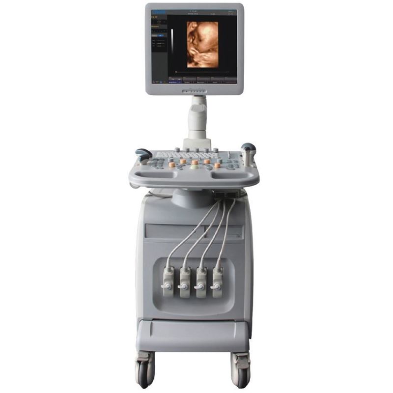 Chison i3